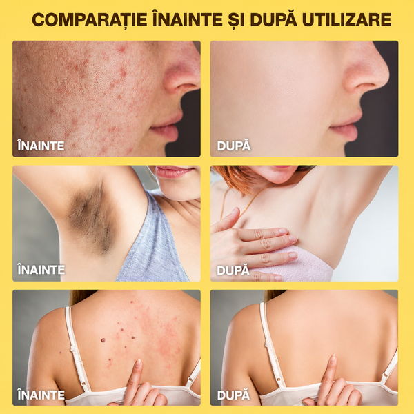 Cremă Hidratantă Venin de Albine